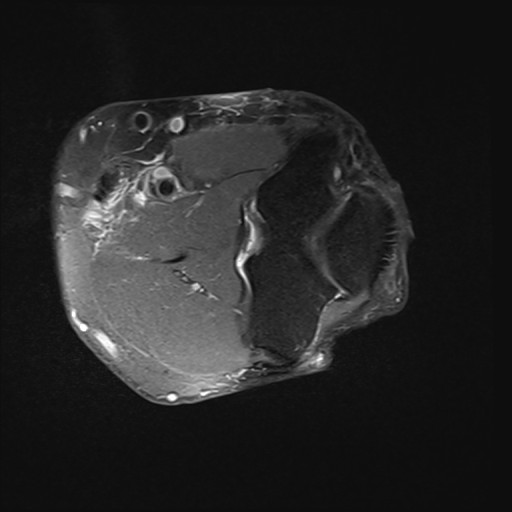 Click on the Serie image to view the images of Wieszt, Gnter